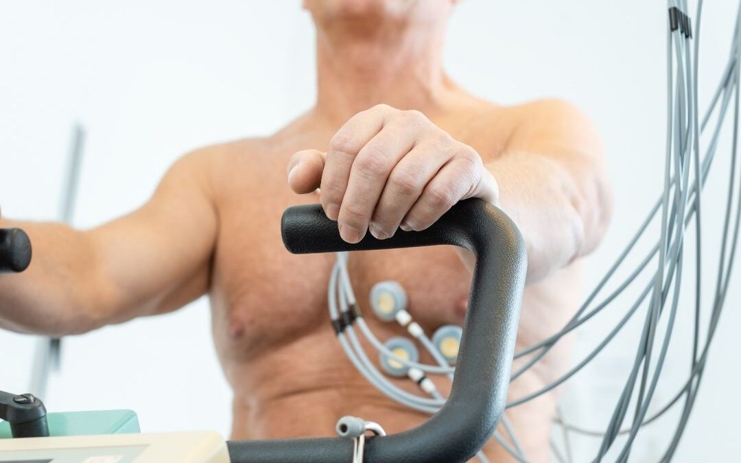 Electrocardiograma